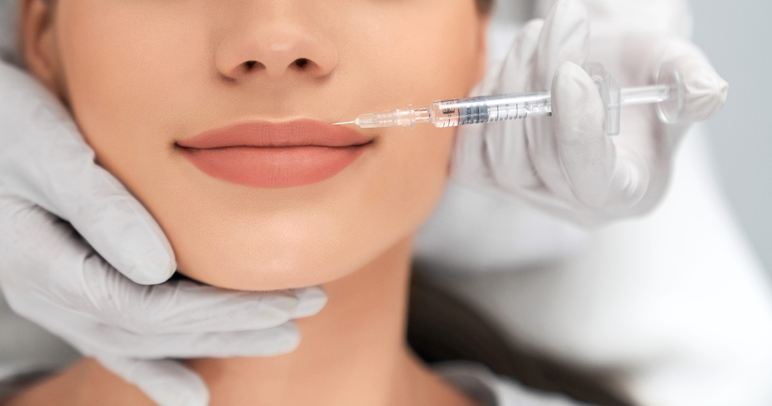 How Long Do Radiesse Injections Last scaled