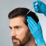 Hair Health Restoration by Refine Medical Center in Eugene, OR