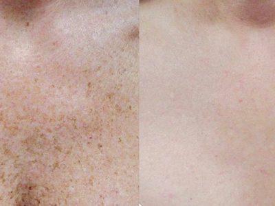 Before & after images in 690 Van Buren St, Eugene, OR| Refine Medical Center