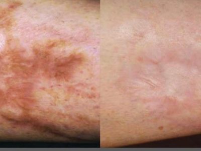 Before & after images in 690 Van Buren St, Eugene, OR| Refine Medical Center