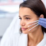 PDO Body Threads in 690 Van Buren St, Eugene, OR| Refine Medical Center